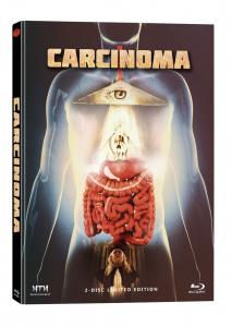 Carcinoma (Limited Mediabook, Blu-ray+DVD) (2014) [FSK 18] [Blu-ray] 