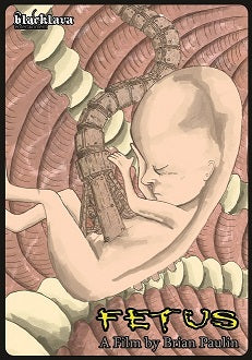 Fetus (Uncut, im Schuber) (2008) [FSK 18] [Gebraucht - Zustand (Sehr Gut)] 